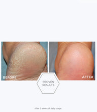 Pedi Peel